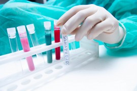 Aktuelles zum Coronavirus 2019-nCoV Person mit medizinischer Schutzkleidung und Testampullen